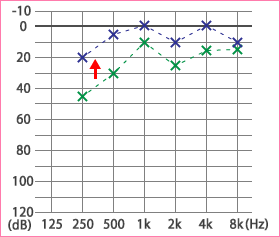 めまい・メニエール病・PPPD