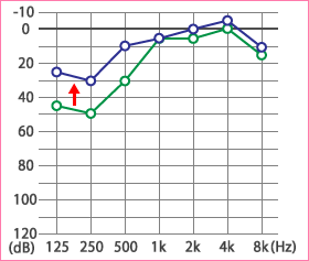 めまい・メニエール病・PPPD