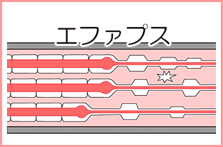 顔面神経麻痺：後遺症のけいれん